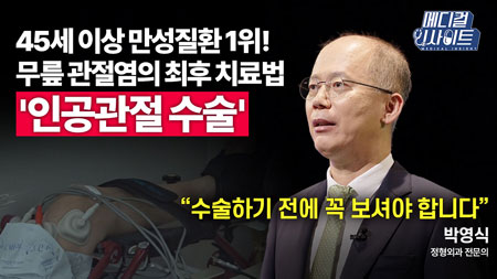 자연스러운 노화 현상 무릎 통증? 방치하면 큰일 난다!ㅣ메디컬 인사이트[54회]