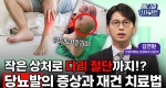 작은 상처로 다리 절단까지!? 당뇨발의 증상과 재건 치료법ㅣ메디컬 인사이트[90회]