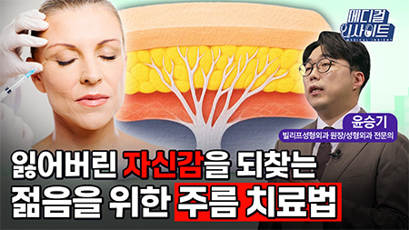잃어버린 자신감을 되찾는 젊음을 위한 주름 치료법ㅣ메디컬 인사이트[94회]