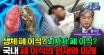 생체 폐 이식? 장기이식? 국내 폐 이식의 현재와 미래ㅣ메디컬 인사이트[95회]