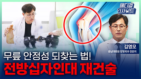 무릎 안정성을 되찾는 법! 전방십자인대 재건술ㅣ메디컬 인사이트[96회]