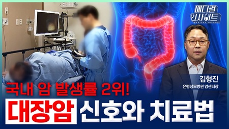 국내 암 발생률 2위! 대장암 신호와 치료법ㅣ메디컬 인사이트[102회]