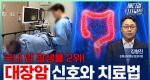 국내 암 발생률 2위! 대장암 신호와 치료법ㅣ메디컬 인사이트[102회]