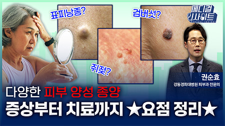 다양한 피부 양성 종양 증상부터 치료까지 ★요점 정리★ㅣ메디컬 인사이트[105회]