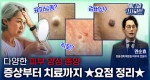 다양한 피부 양성 종양 증상부터 치료까지 ★요점 정리★ㅣ메디컬 인사이트[105회]