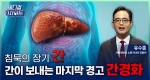 침묵의 장기 간, 간이 보내는 마지막 신호 ‘간경화’ㅣ메디컬 인사이트[107회]