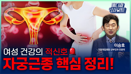 여성 건강의 적신호 여성 건강의 적신호, 자궁근종 핵심 정리!ㅣ메디컬 인사이트[109회] 