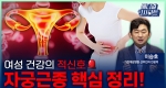 여성 건강의 적신호 여성 건강의 적신호, 자궁근종 핵심 정리!ㅣ메디컬 인사이트[109회] 