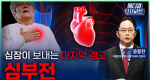 심장이 보내는 마지막 경고 심부전ㅣ메디컬 인사이트[118회]