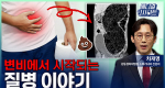 변비에서 시작되는 질병 이야기ㅣ메디컬 인사이트[124회]