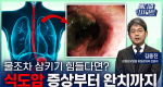 물조차 삼키기 힘들다면? 식도암 증상부터 완치까지ㅣ메디컬 인사이트[128회]