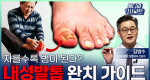 자를수록 병이 된다? 내성발톱 완치 가이드ㅣ메디컬 인사이트[129회]