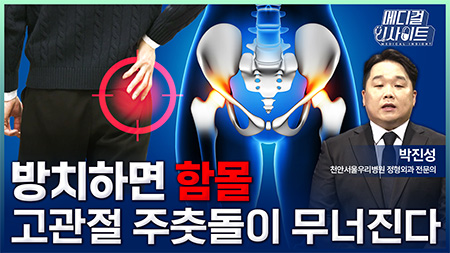 방치하면 함몰, 고관절 주춧돌이 무너진다ㅣ메디컬 인사이트[133회]
