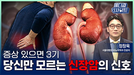 증상 있으면 3기, 당신만 모르는 신장암의 신호ㅣ메디컬 인사이트[134회]