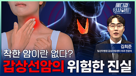  착한 암이란 없다? 갑상선암의 위험한 진실ㅣ메디컬 인사이트[135회]