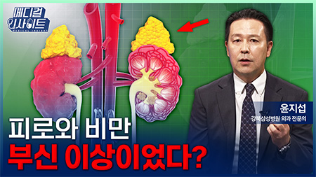  피로와 비만, 부신 이상이었다? 내 호르몬을 뒤흔드는 부신 질환ㅣ메디컬 인사이트[147회]
