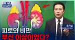  피로와 비만, 부신 이상이었다? 내 호르몬을 뒤흔드는 부신 질환ㅣ메디컬 인사이트[147회]