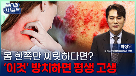 대상포진 후 신경통 막는 골든타임 72시간의 비밀ㅣ메디컬 인사이트[151회]