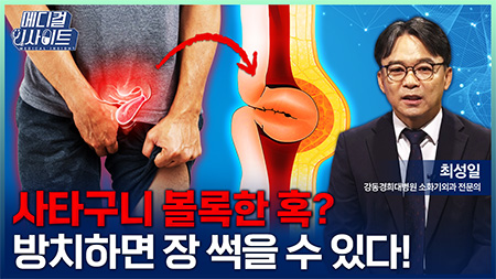 방치하면 장 썩는 ‘탈장’의 증상과 치료법ㅣ메디컬 인사이트[156회]
